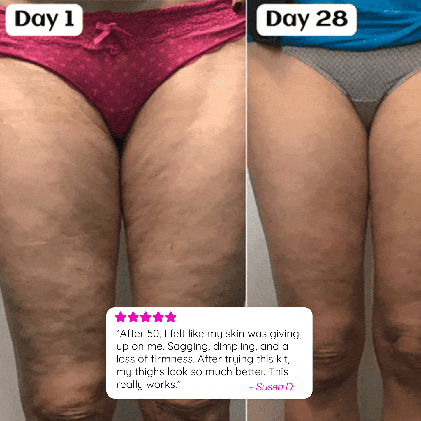 She’s Sculpted Set™