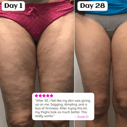 She’s Sculpted Set™