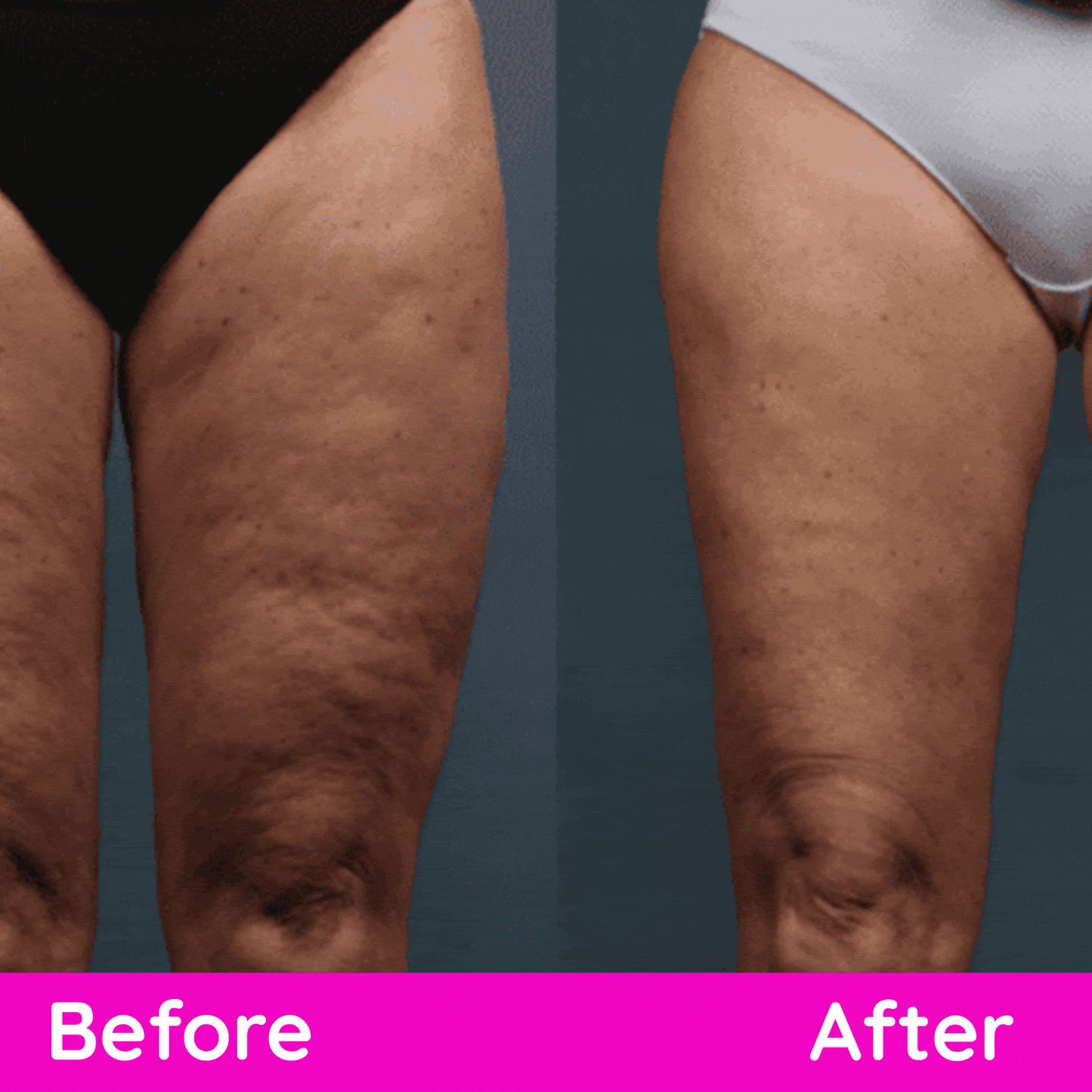 She’s Sculpted Set™