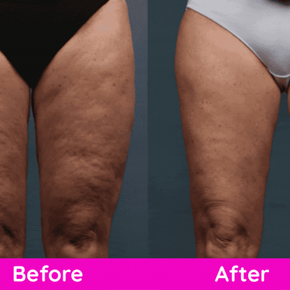 She’s Sculpted Set™